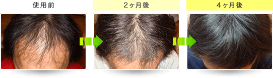 効果イメージ